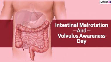 Intestinal Malrotation and Volvulus Awareness Day 2020: Date & Significance of the Day; Symptoms and Risk Factors of The Birth Defect to Keep in Mind