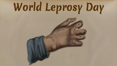 World Leprosy Day 2020: What Is Leprosy? Know More About the Causes, Symptoms and Treatment of Hansen’s Disease