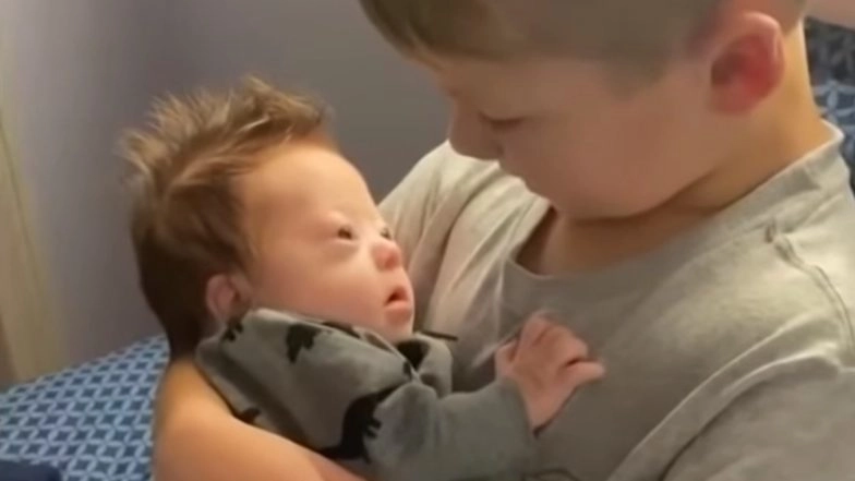 World Down Syndrome Day 2021 Date, History and Significance: Know More About the Day Dedicated to Raising Public Awareness of Trisomy 21