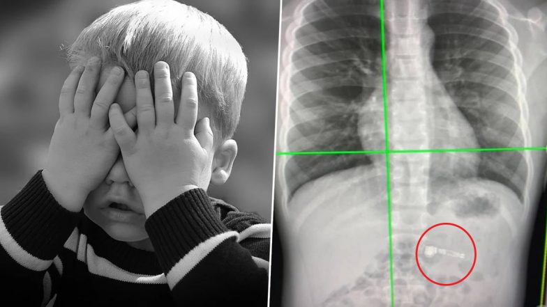 7-YO Boy Swallows AirPod He Received as Christmas Gift, Docs Say Let it Pass Through His System