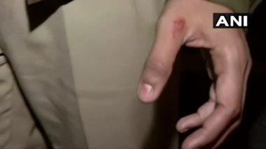 Woman Bites IPS Officer Ingit Pratap Singh's Thumb During JNU Students' Protest in Delhi