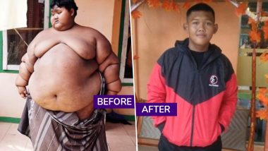 Indonesia's Fattest Teenager Arya Permana Loses 110kg, Amazing Body Transformation With Before And After Pictures Go Viral