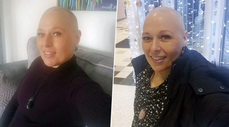 Breast Cancer: Woman Throws a Farewell Party with 'Boob Cake' and 'Nipple Biscuits', Days Before Double Mastectomy