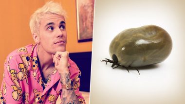 Justin Bieber Reveals He Is Battling Lyme Disease, Dissing 'Meth' rumours; Know More Lyme Disease and Its Symptoms