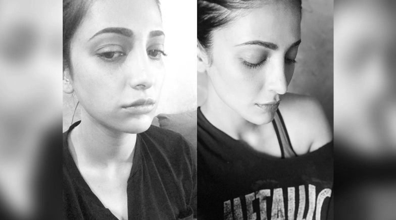 Shruti Haasan Admits of Undergoing a Plastic Surgery in Her New Instagram Post