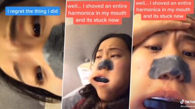 TikTok Video of Canadian Teenager Getting a WHOLE Harmonica Stuck Inside Her Mouth Goes Viral