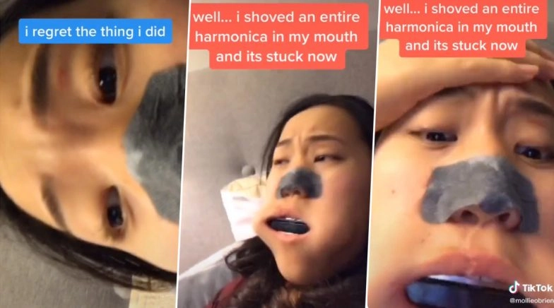 TikTok Video of Canadian Teenager Getting a WHOLE Harmonica Stuck Inside Her Mouth Goes Viral