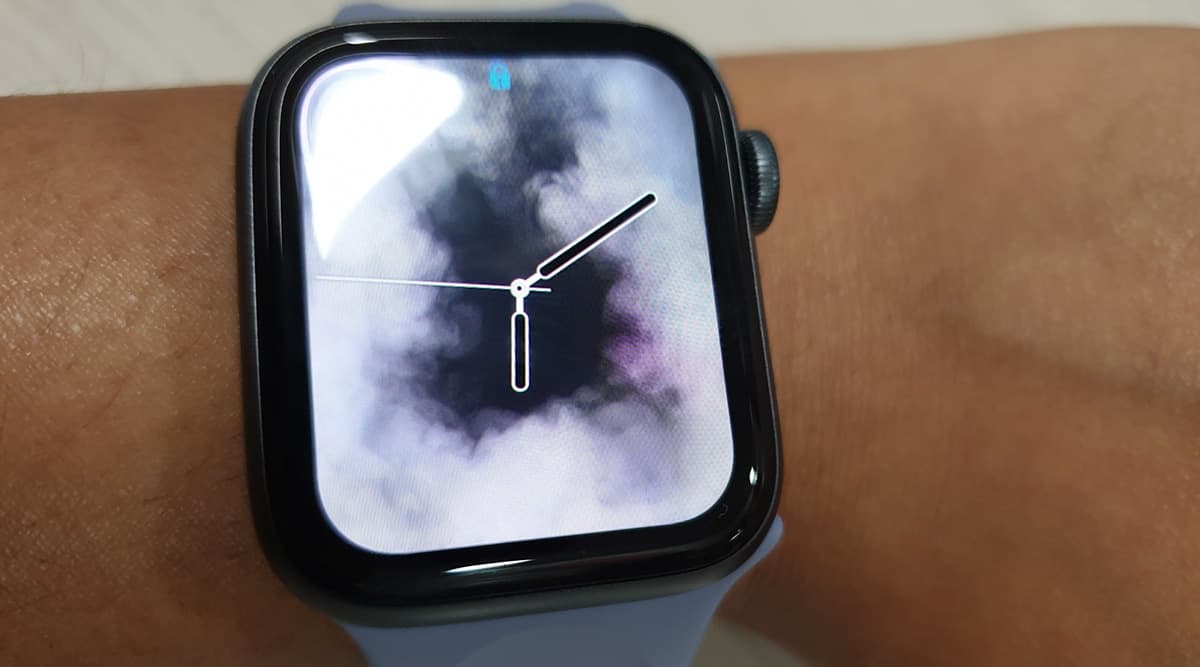 Apple Watch Saves A Life of Teen Athlete Named Skylar Joslin By Notiftying Him His Abnormal Rapid Heart Rate Apple Watch Saves A Life of Teen Athlete Named Skylar Joslin By Notiftying Him His Abnormal Rapid Heart Rate