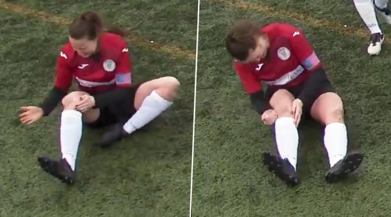 Scottish Footballer Jane O’Toole Hammers Dislocated Knee Back In Place and Continues Playing 