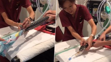 Doctors Remove Beach Towel From Pet Python Monty's Stomach (Watch Graphic Video)