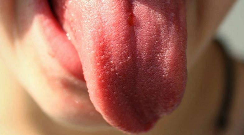 Jar Full of Preserved Human Tongues Found Hidden 