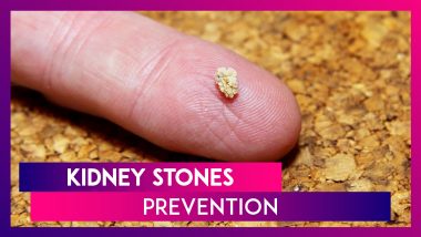 Different Types Of Kidney Stones And How To Prevent Them: World Kidney Day 2020