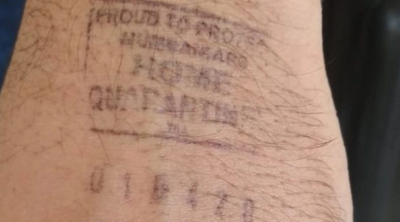 Quarantine Stamp Ink Causes Blisters, Burns; Cases Reported From Gujarat and Goa