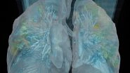 Lung Damage in Coronavirus Patients: Video by Washington DC Hospital Releases a VR Fly-Through of COVID-19 Positive Patient's Lungs