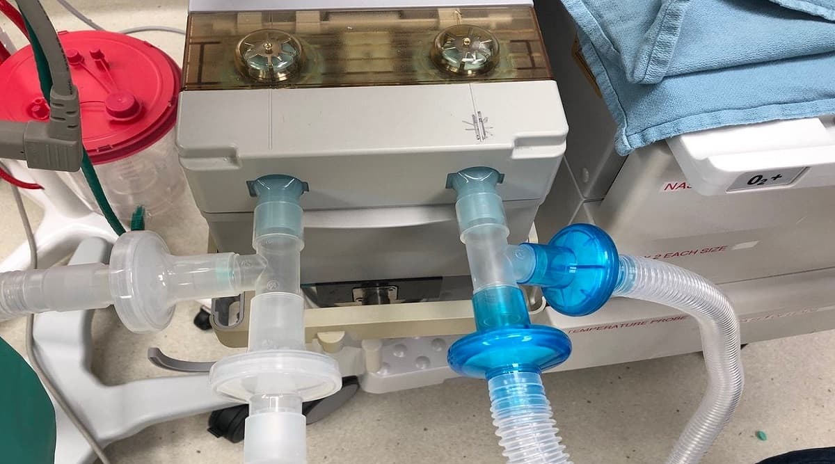 Mahindra Group Working on Manufacturing Prototypes of Ventilators Costing Less Than Rs 7,500 to Combat Coronavirus Outbreak Mahindra Group Working on Manufacturing Prototypes of Ventilators Costing Less Than Rs 7,500 to Combat Coronavirus Outbreak