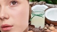 Home Remedy Of The Week: Coconut Oil For Sun Tan Removal; Here's How to Detan Your Skin Naturally (Watch Video)