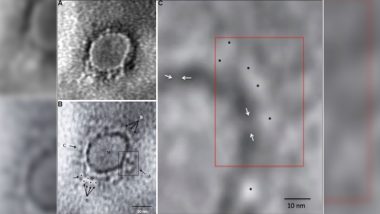 What Does COVID-19 Look Like? Indian Scientists Reveal Microscopic Image of SARS-CoV-2 Virus Causing Coronavirus Pandemic