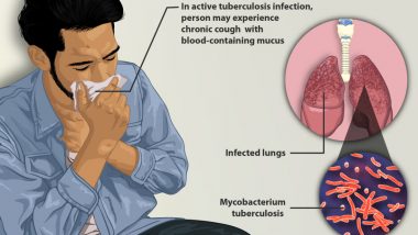 World TB Day 2020 Date and Theme: Significance of the Day to Raise Awareness About the Global Epidemic of Tuberculosis