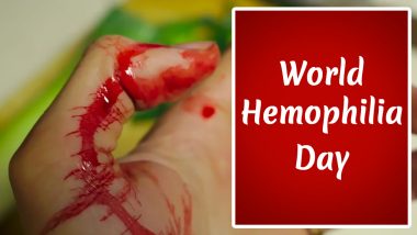 World Hemophilia Day 2020 Myths and Facts: From 'Outgrowing Haemophilia' to 'Clotting Factor VIII', Here Are Things About the Blood Disorder You Should Know Of