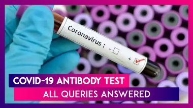 What Is The COVID-19 Antibody Test? All You Need To Know About Its Mechanism And Accuracy