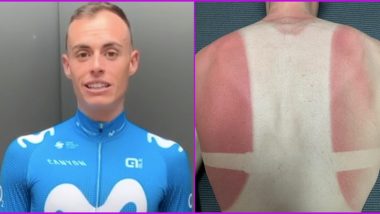 Enric Mas Nicolau, Spanish Cyclist, Suffers Brutal Sunburn After Training on Home Balcony Amid Coronavirus Lockdown (View Photo)