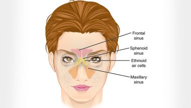 Are You Suffering From Sinus? Follow These Five Tips to Reduce Symptoms of Sinusitis