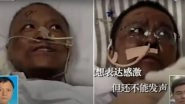 Wuhan Doctors' Skin Turns Dark After Undergoing Treatment For COVID-19 in China