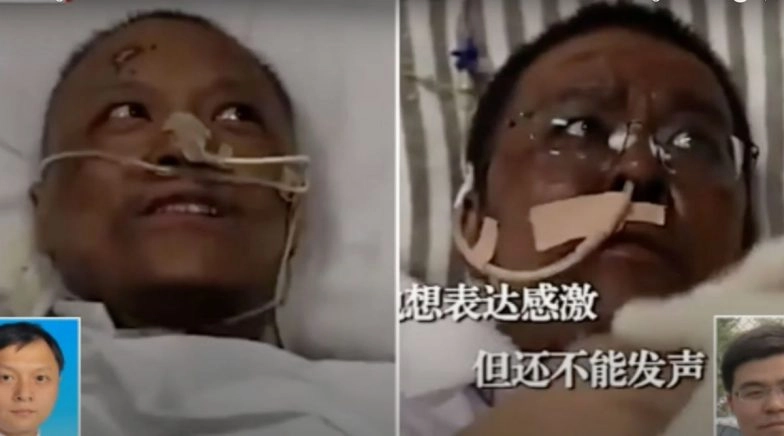 Wuhan Doctors' Skin Turns Dark After Undergoing Treatment For COVID-19 in China