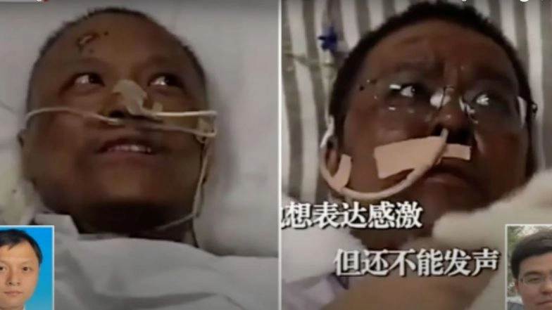 Wuhan Doctors' Skin Turns Dark After Undergoing Treatment For COVID-19 in China