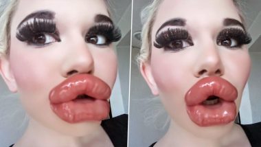 Woman With 'Biggest Lips in World' Shares Pictures After Her 20th Lip Job, Receives Mixed Reactions on Instagram