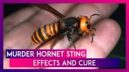 Did You Get Stung By An Asian Giant Murder Hornet? Here Are Steps to Care For The Deadly Sting