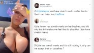 Kylie Jenner Shares Pic of Stretch Marks on Boobs on Instagram! Netizens Praise the Beauty Mogul for Crushing Fake Beauty Standards