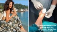 Karishma Tanna Undergoes A 'Toe Surgery' Amid Lockdown (View Pics)