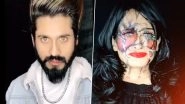 TikTok Star Faizal Siddiqui&rsquo;s Account Banned for Glorifying Acid Attack