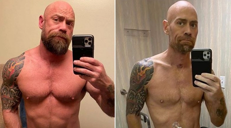 Mike Schultz, Nurse and COVID-19 Survivor Shares Dramatic Before and After Pics