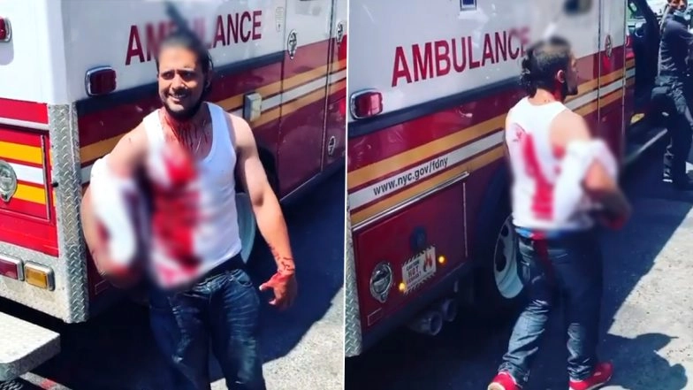 New York Man Walks With Knife Stuck on His Head, Seeks Help From Nearest Ambulance