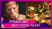 World Vitiligo Day 2020: Diet To Stop The Progression Of The Skin Disease