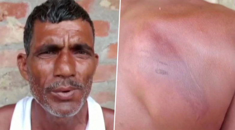 India-Nepal Border Firing: Bihar Man, Who Was Detained by Nepali Forces, Released