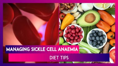 World Sickle Cell Day 2020: Know How To Manage Sickle Cell Anaemia With Your Diet