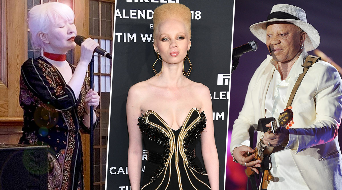 International Albinism Awareness Day 2020: Famous Albino Personalities Who  Didn't Let Their Skin Disorder Hamper Their Big Dreams | ?️ LatestLY