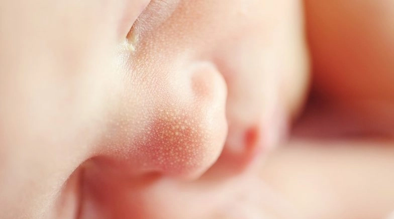 Madhya Pradesh: Woman Gives Birth to Baby Without Any Limbs, Doctors Baffled!