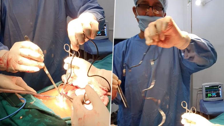 Guwahati Man Approaches Hospital After Abdominal Pain, Doctors Find Mobile Charger in His Urinary Bladder as Result of Masturbation