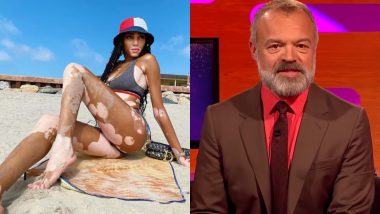 World Vitiligo Day 2020: Model Winnie Harlow to TV Personality Graham Norton, Celebrities With Vitiligo Who Are Inspiration to Those With the Skin Condition to Pursue Their Dreams