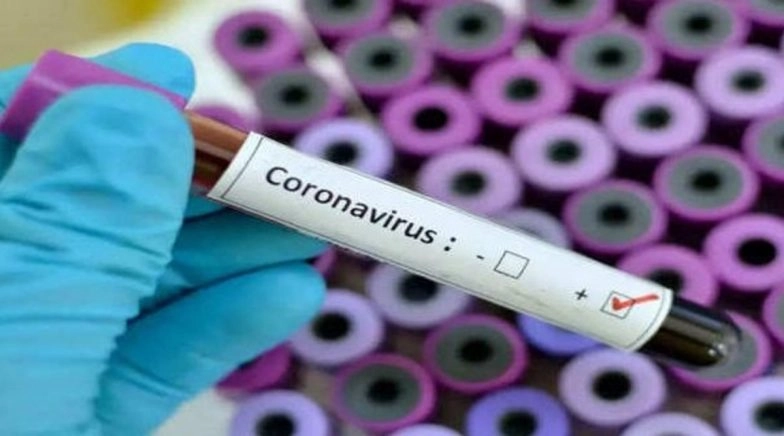 Mumbai: 105 MSRTC Bus Staff Contract COVID-19 After Working for BEST Buses