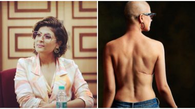 National Cancer Survivors Day 2020: Tahira Kashyap Pens A Beautiful Poem Paying An Ode To Her 'Scars'