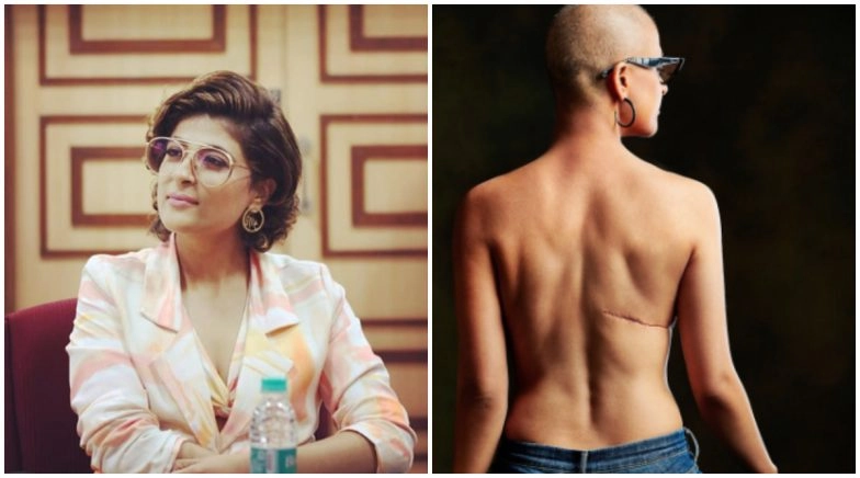 Cancer Survivor Tahira Kashyap Pens A Beautiful Poem