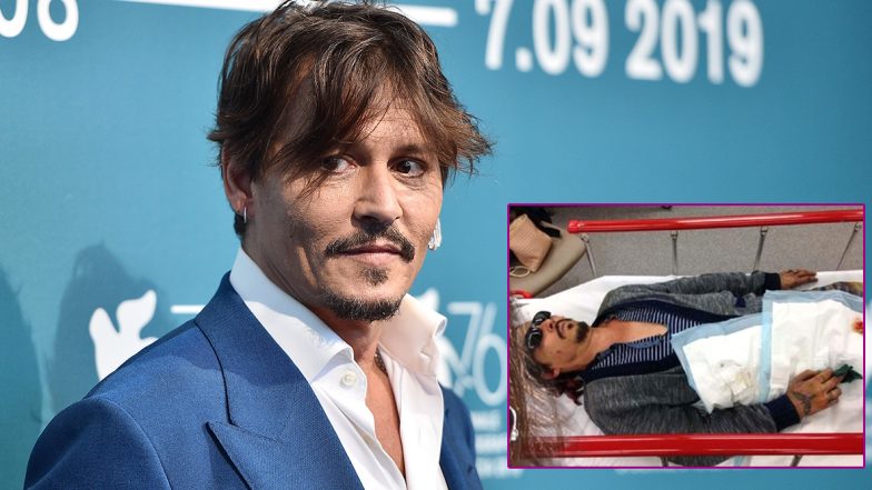 Johnny Depp Accuses Ex-Wife Amber Heard of Severing his Finger By Throwing a Vodka Bottle, Shows Picture of His Injury in the Court