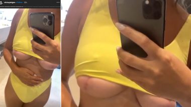 Chrissy Teigen Bares Her Boob Scars on Instagram Because 'No One Believes' That She Has Had Her Breast Implants Removed! (View Pics)