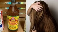 Home Remedy of the Week: How Apple Cider Vinegar Can Help Treat Dandruff And Itchy Scalp (Watch Video)