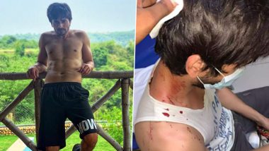 Dil Toh Happy Hai Ji Fame Ansh Bagri Assaulted By Men Outside His House, Sustains Head Injuries (View Pic)